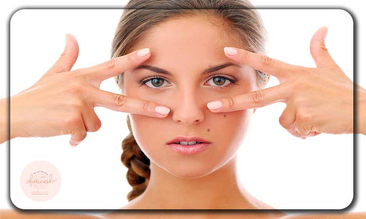 بوتاکس چشم روباهی