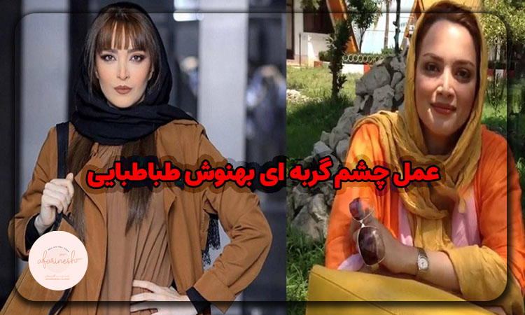 عمل چشم گربه ای بهنوش طباطبایی