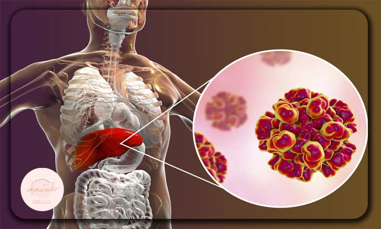 آیا ایدز باعث ریزش مو میشود؟