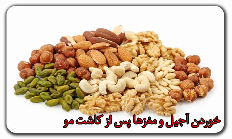 خوردن آجیل و مغزها پس از کاشت مو