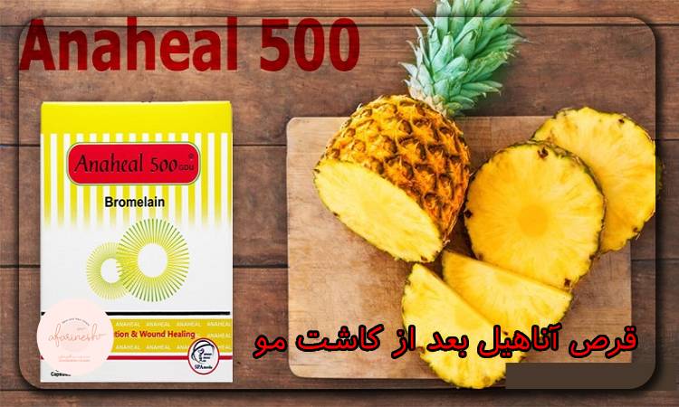 قرص آناهیل بعد از کاشت مو