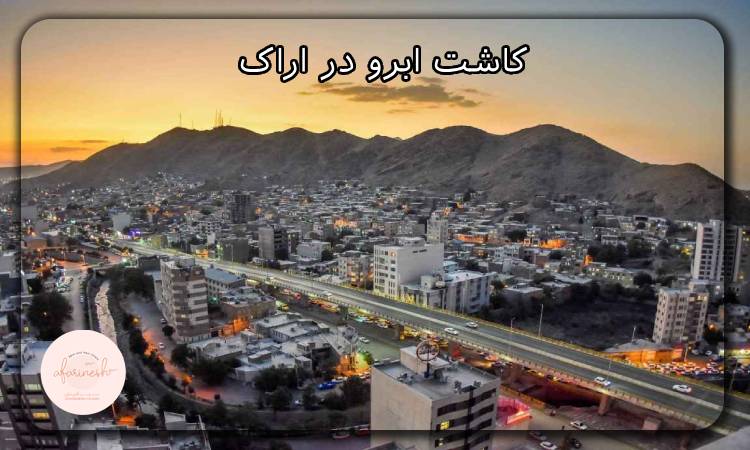 کاشت ابرو در اراک