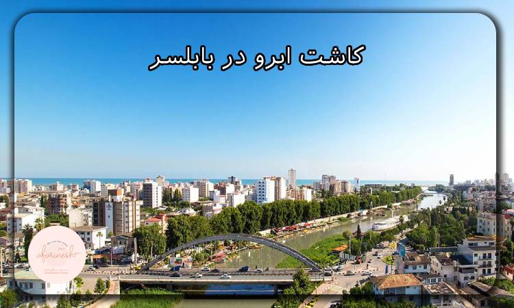 کاشت ابرو در بابلسر