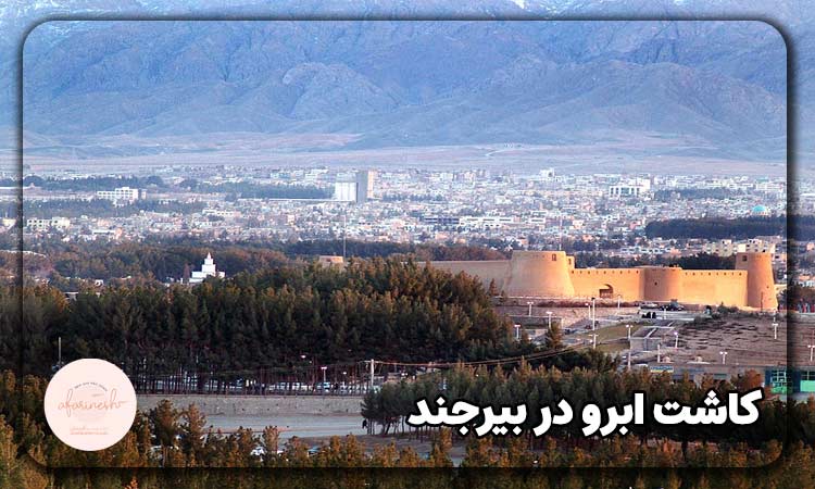 کاشت ابرو در بیرجند