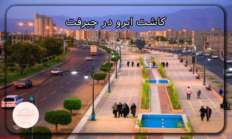 کاشت ابرو در جیرفت