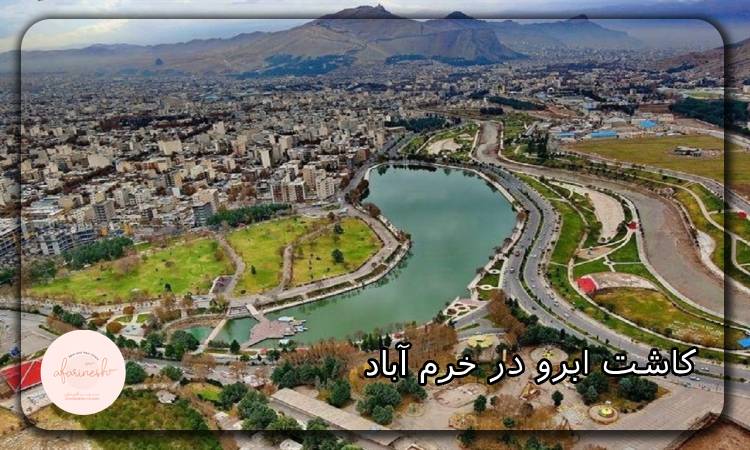 کاشت ابرو در خرم آباد