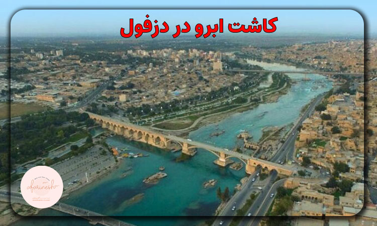 کاشت ابرو در دزفول