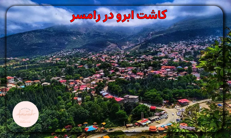 کاشت ابرو در رامسر