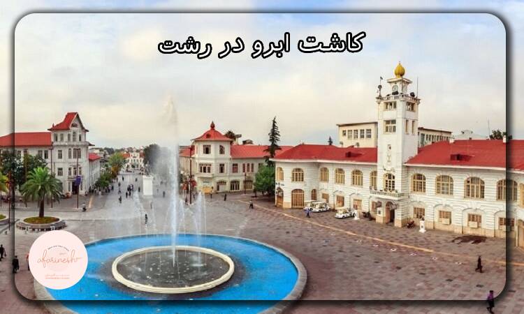 کاشت ابرو در رشت