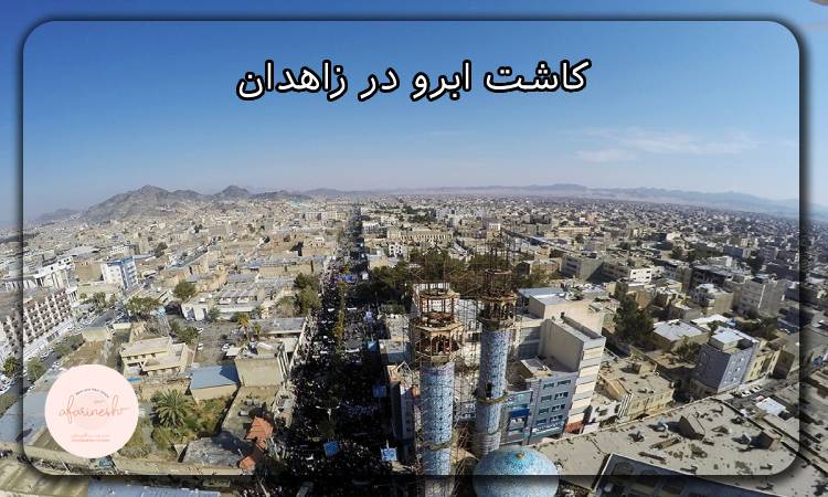 کاشت ابرو در زاهدان
