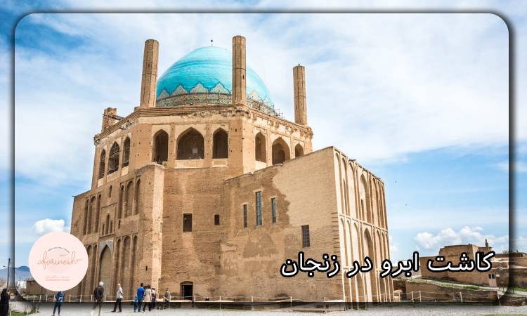کاشت ابرو در زنجان