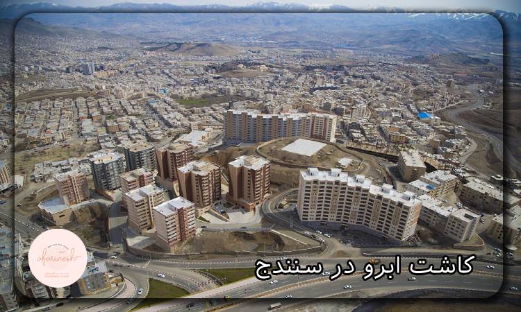 کاشت ابرو در سنندج