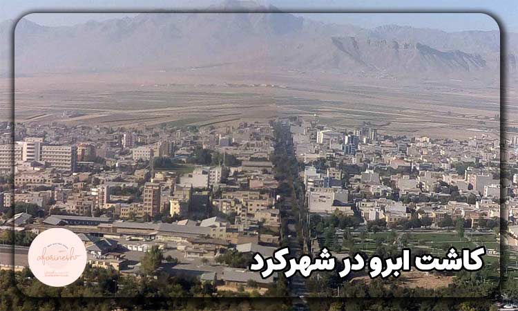 کاشت ابرو در شهرکرد