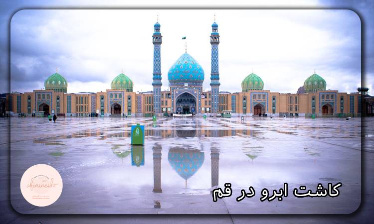 کاشت ابرو در قم