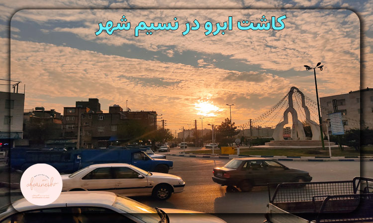 کاشت ابرو در نسیم شهر
