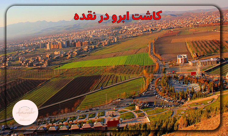 کاشت ابرو در نقده