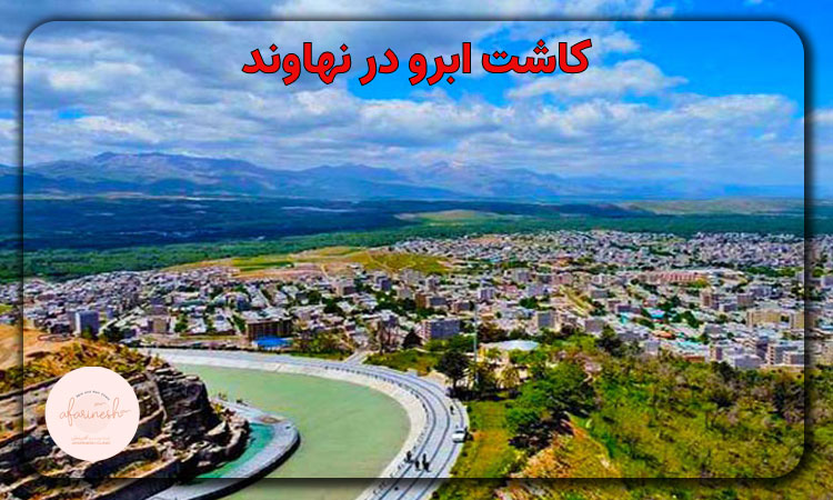کاشت ابرو در نهاوند