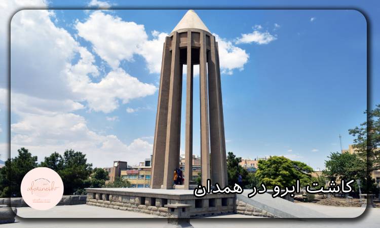 قیمت کاشت ابرو در همدان