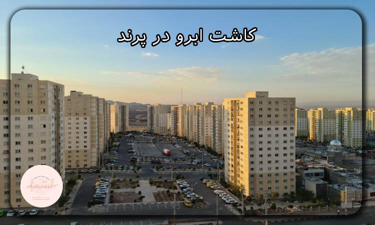 کاشت ابرو در پرند