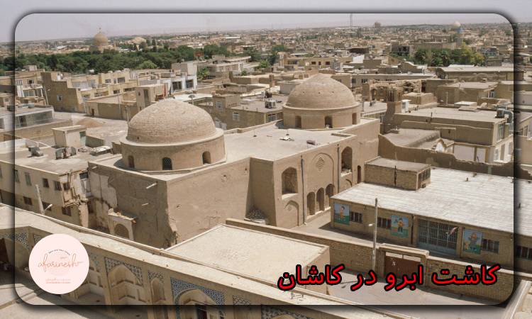 کاشت ابرو در کاشان