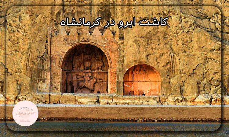کاشت ابرو در کرمانشاه