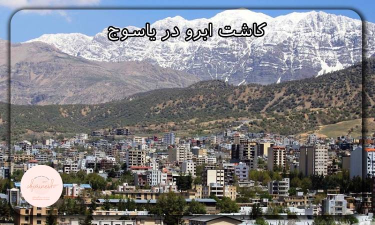 کاشت ابرو در یاسوج