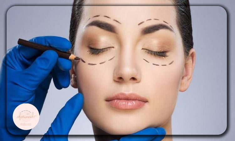 مراحل استفاده از بیمه نیروهای مسلح برای عمل بلفاروپلاستی