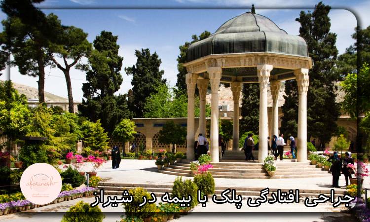 جراحی افتادگی پلک با بیمه در شیراز