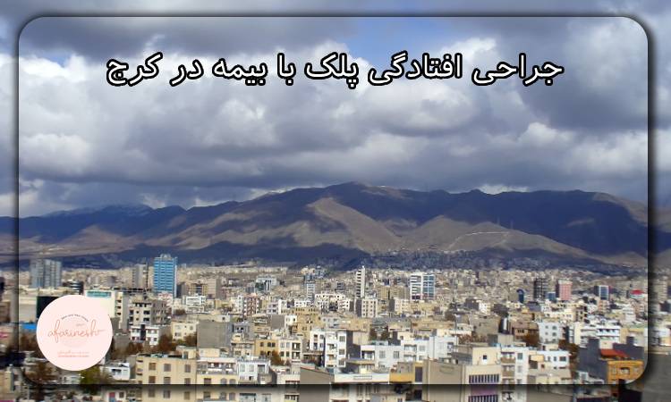 جراحی افتادگی پلک با بیمه در کرج