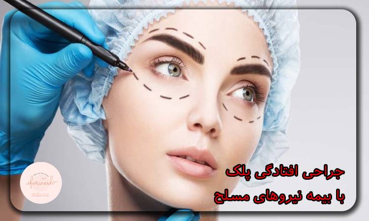 جراحی افتادگی پلک با بیمه نیروهای مسلح
