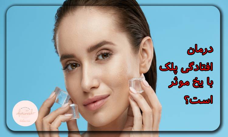 درمان افتادگی پلک با یخ