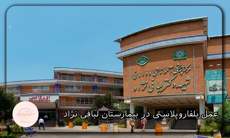 عمل بلفاروپلاستی در بیمارستان لبافی نژاد