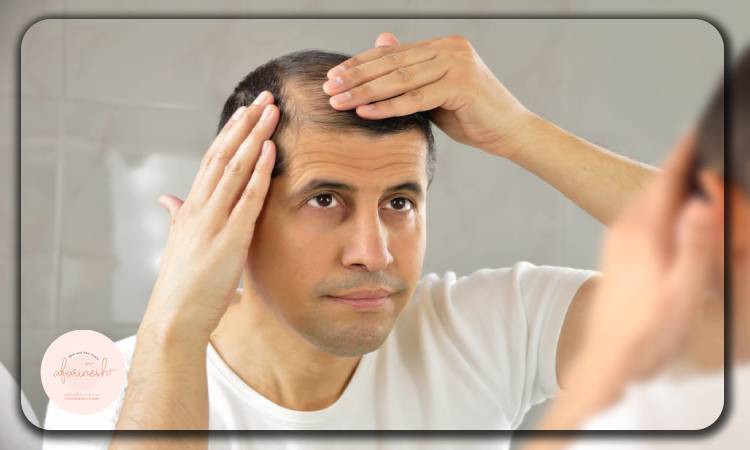 روند بهبودی در ۴۰ روز اول بعد از کاشت مو چگونه است؟