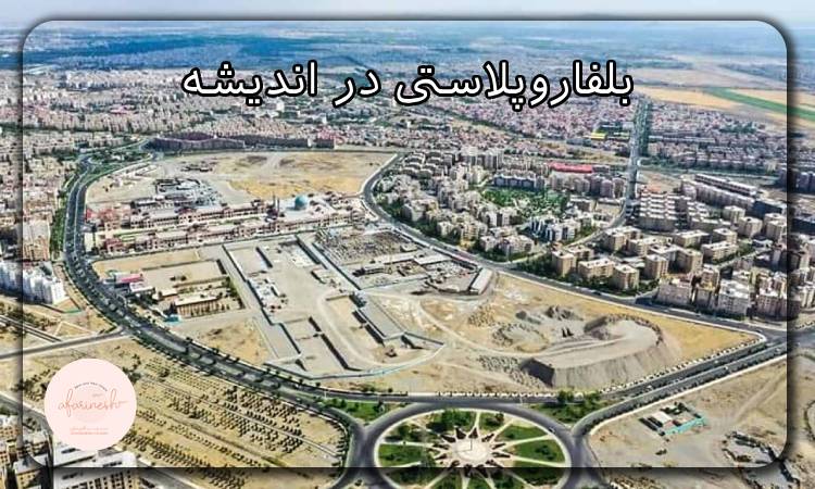 بلفاروپلاستی در اندیشه