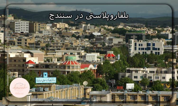 بلفاروپلاستی در سنندج