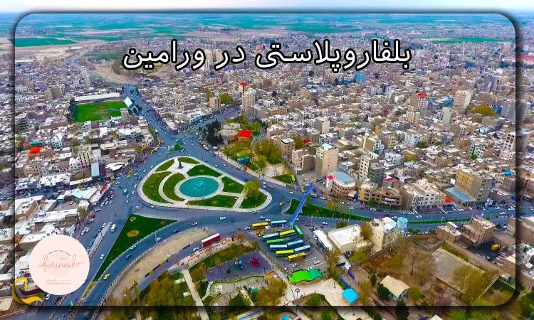 بلفاروپلاستی در ورامین