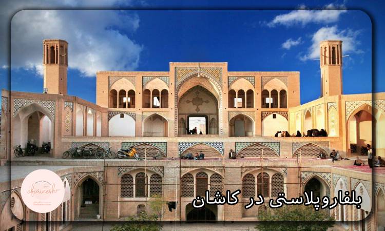 بلفاروپلاستی در کاشان