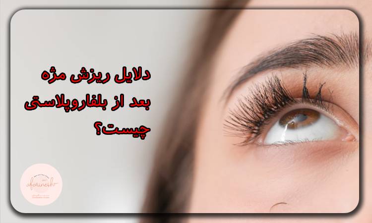 دلایل ریزش مژه بعد از بلفاروپلاستی چیست؟