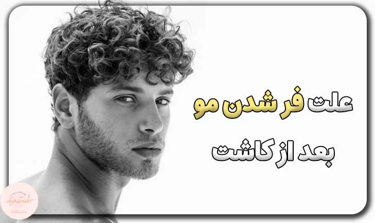 علت فر شدن مو بعد از کاشت