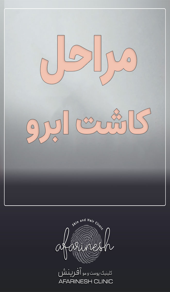 مراحل کاشت ابرو