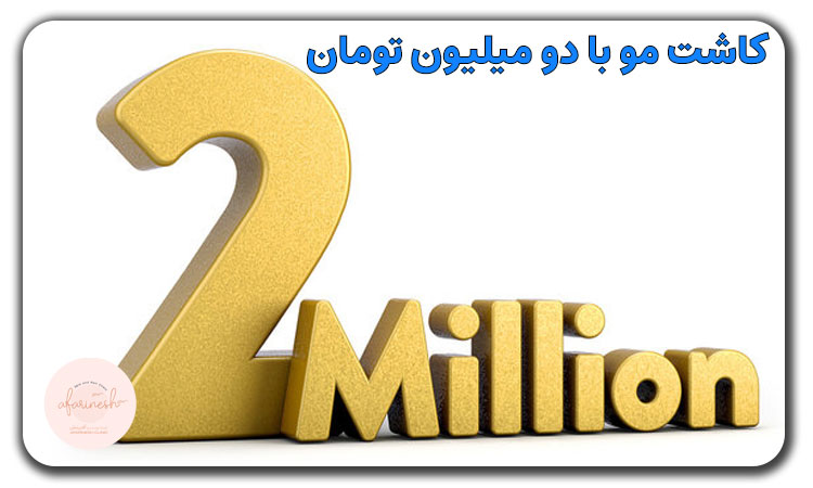 کاشت مو با دو میلیون