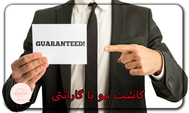 کاشت مو با گارانتی