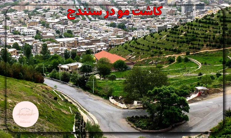 کاشت مو در سنندج