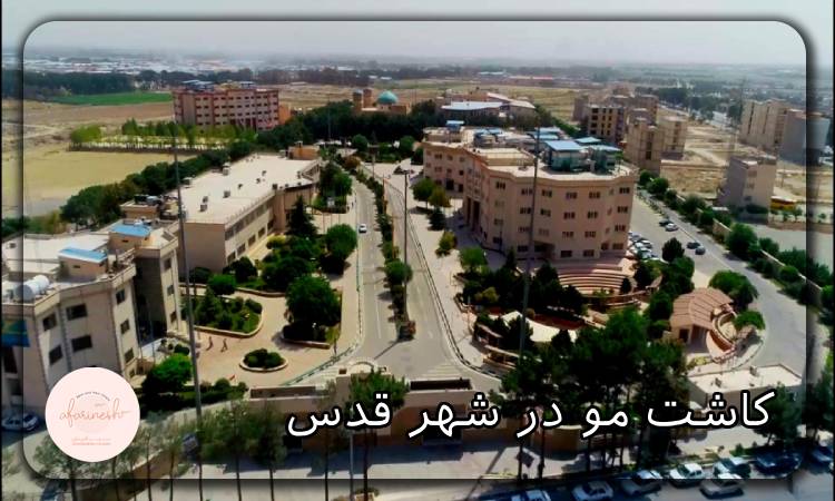 کاشت مو در شهر قدس
