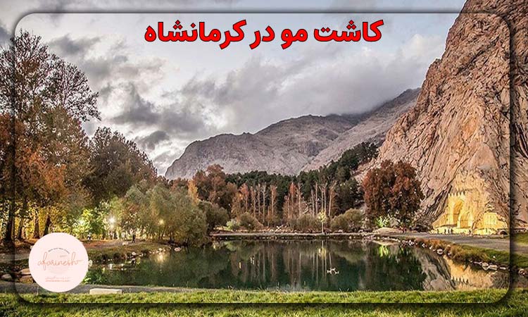 کاشت مو در کرمانشاه