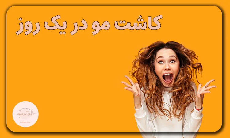 کاشت مو در یک روز
