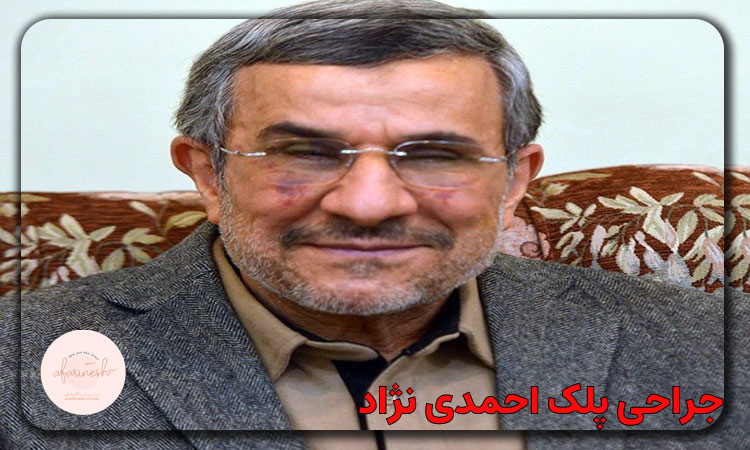 جراحی پلک احمدی نژاد