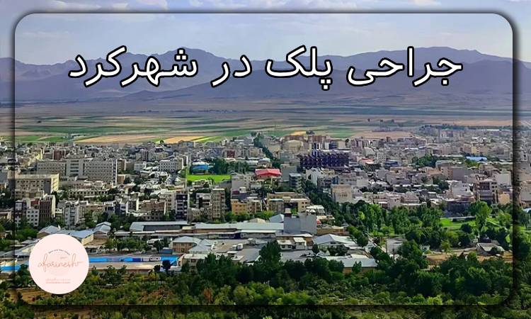 جراحی پلک در شهرکرد