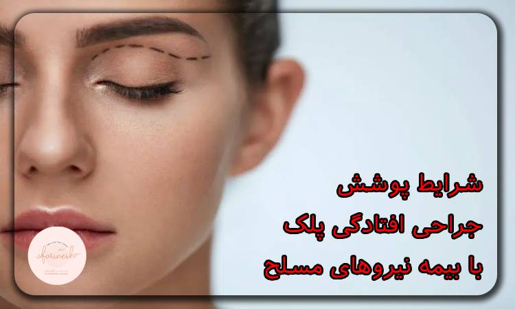 شرایط پوشش جراحی افتادگی پلک با بیمه نیروهای مسلح
