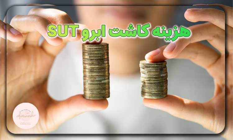 هزینه کاشت ابرو به روش sut
